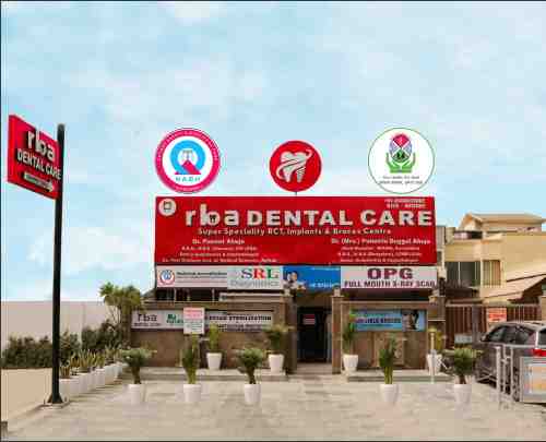 Best Dental Implant Faridabad